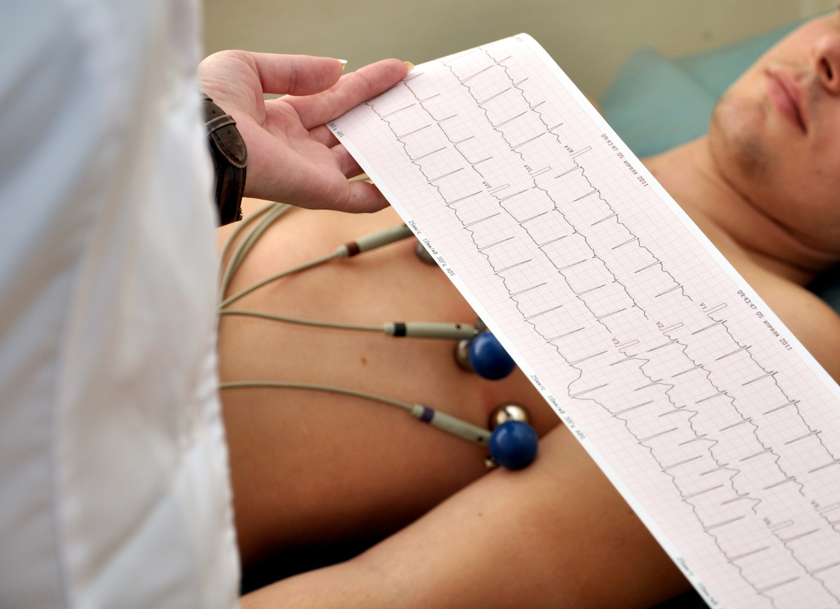 Abnormal EKG: Cause and Treatment